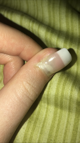 Gerissen nagelbett nagel aus Was tun