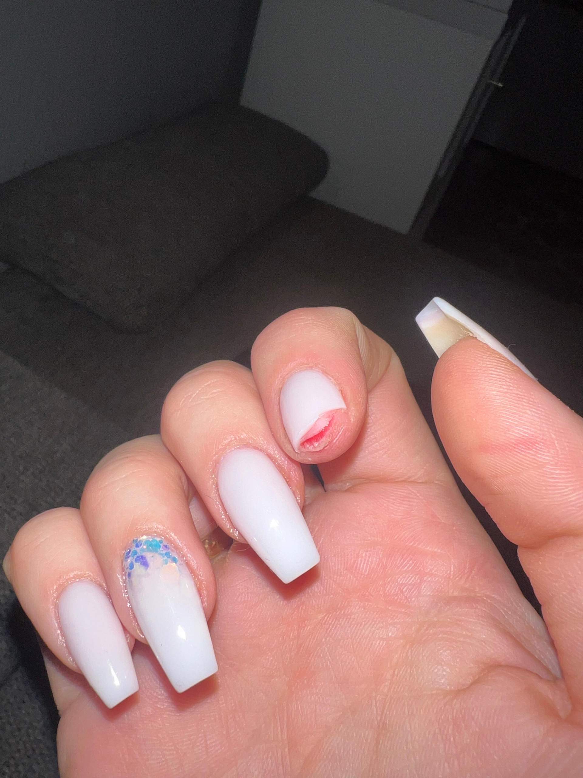 Nagelbett abgerissen, was tun? (Fingernägel, Gelnägel)