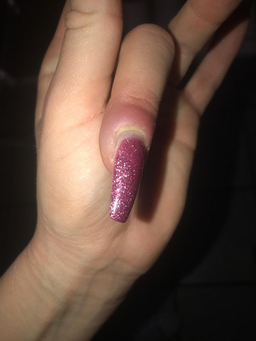 Nagelbettentzundung Erfahrung Medizin Entzundung Manikure