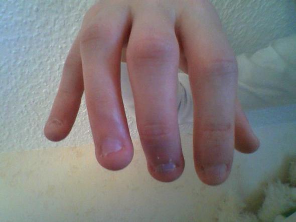 meine Nägel - (Gesundheit, Beauty)