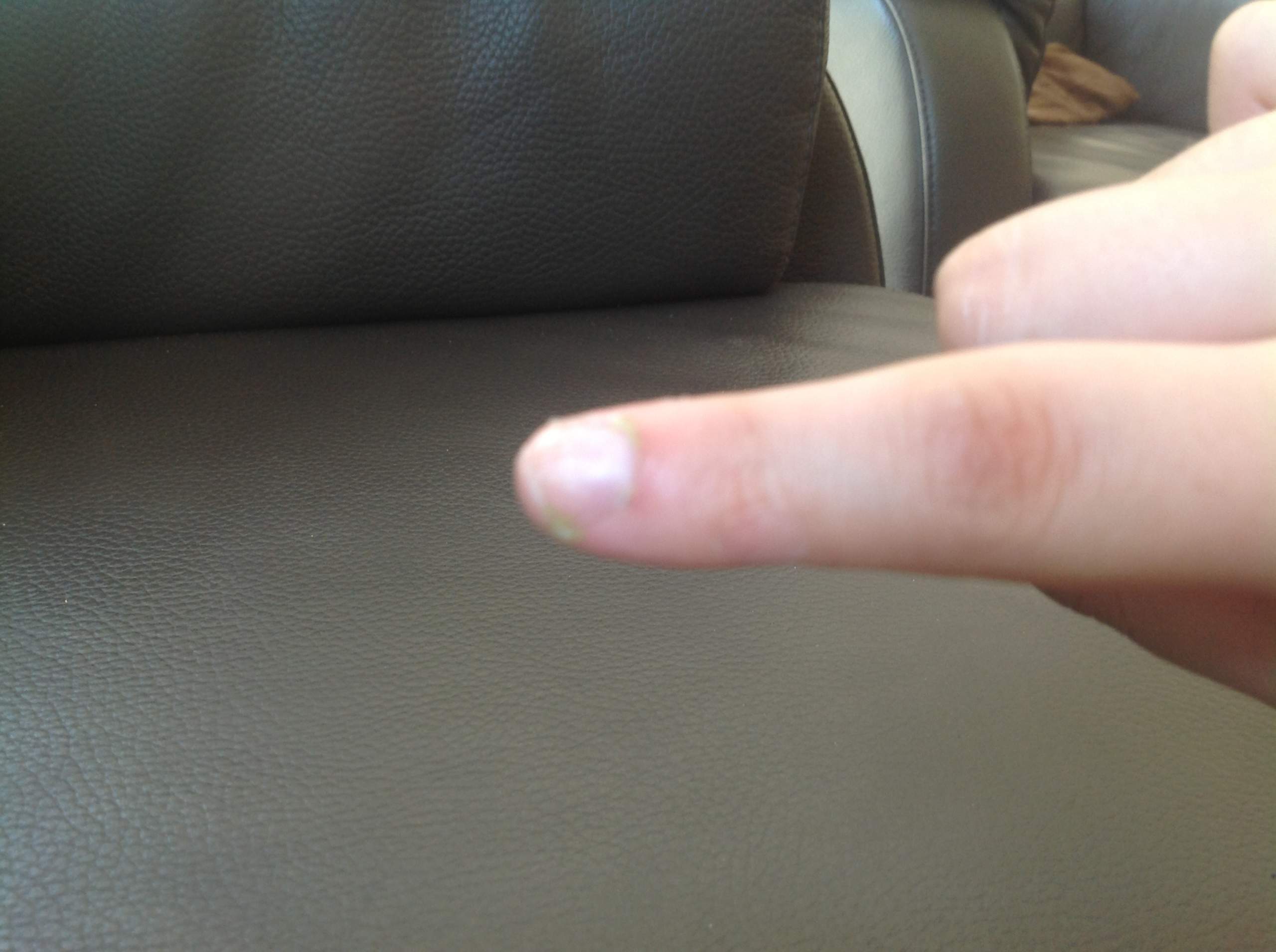 Wie Bekomme Ich Nagelkleber Vom Nagel