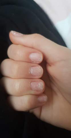 nagelkleber schonend abbekommen nagel nails fake nagel