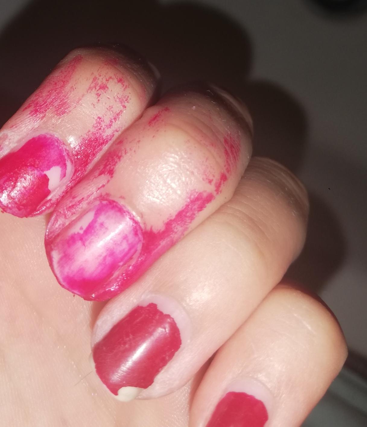 Nagellackpanne Wie Enfernen Beauty Aussehen Nagel