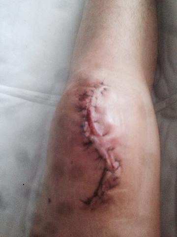 - (Medizin, Arzt, Krankenhaus)