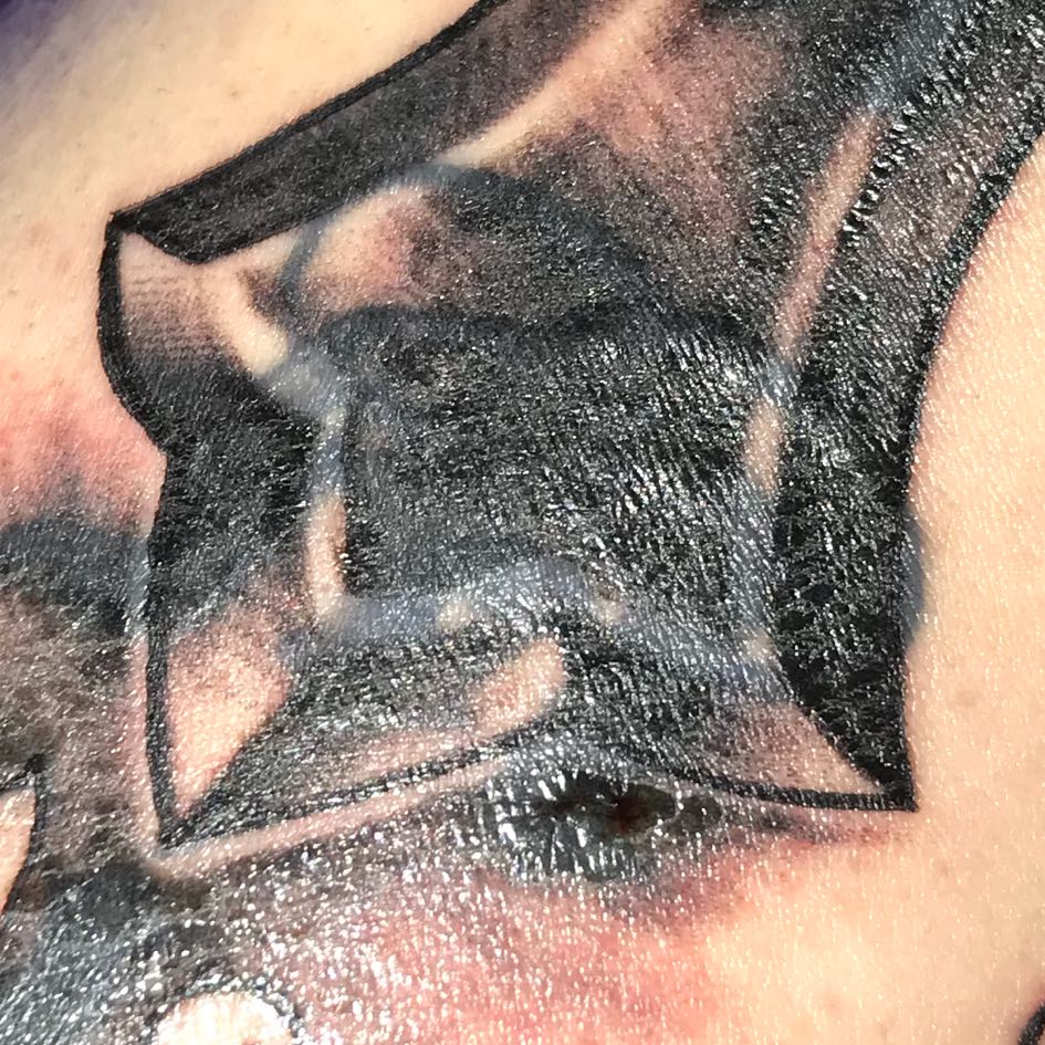 Narbe vom alten Tattoo? (Narben)