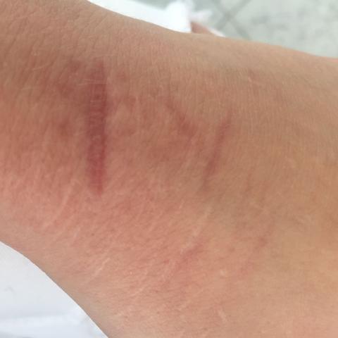 ---&/a - (Beine, Hand, Narben)