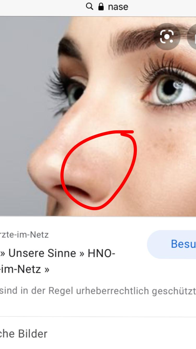 Nase Ohne Op Verandern Nasen Op