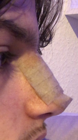 Nasen Op Gesundheit Und Medizin Nasen Op Nasen Op Gesundheit Und Medizin Nasen Op