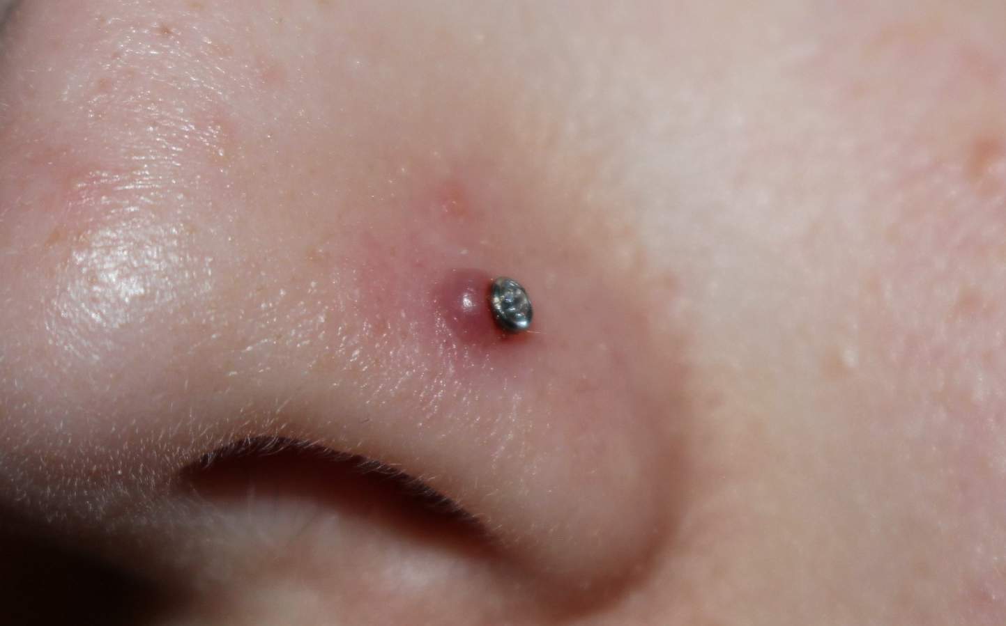 nasenpiercing blutblase oder wildes fleisch was tun blaeschen nostril wildes fleisch