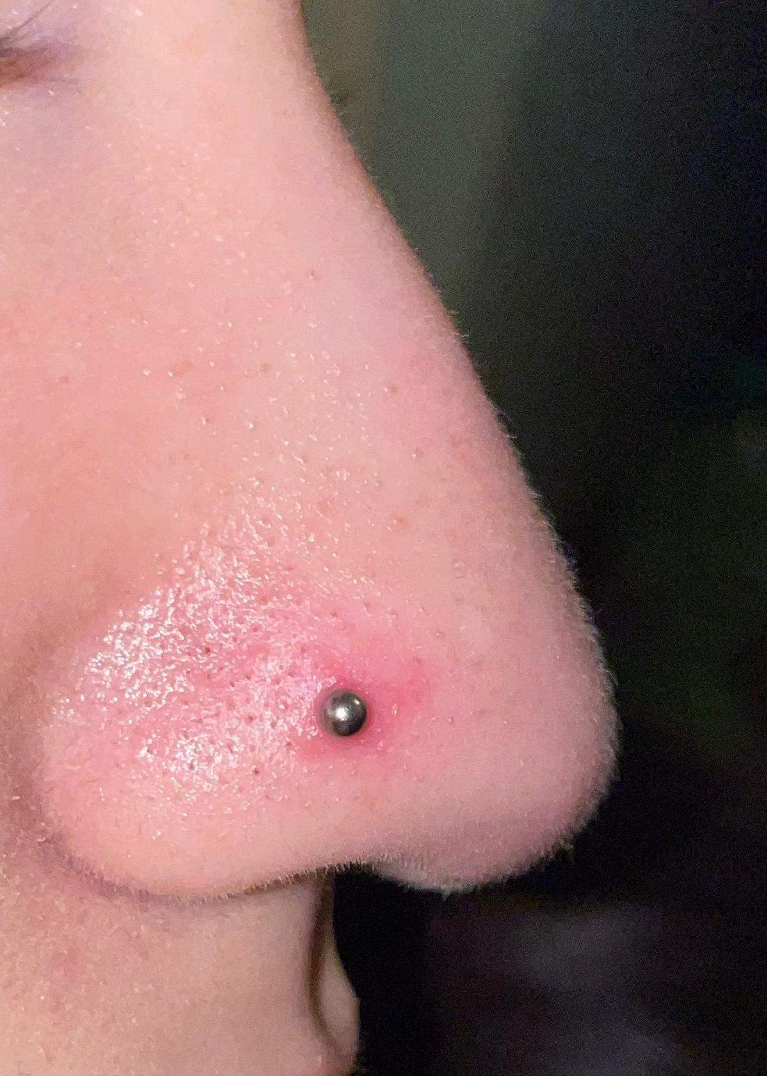 Nasenpiercing heilt nicht ab, ist immer um den stichkanal rot ...