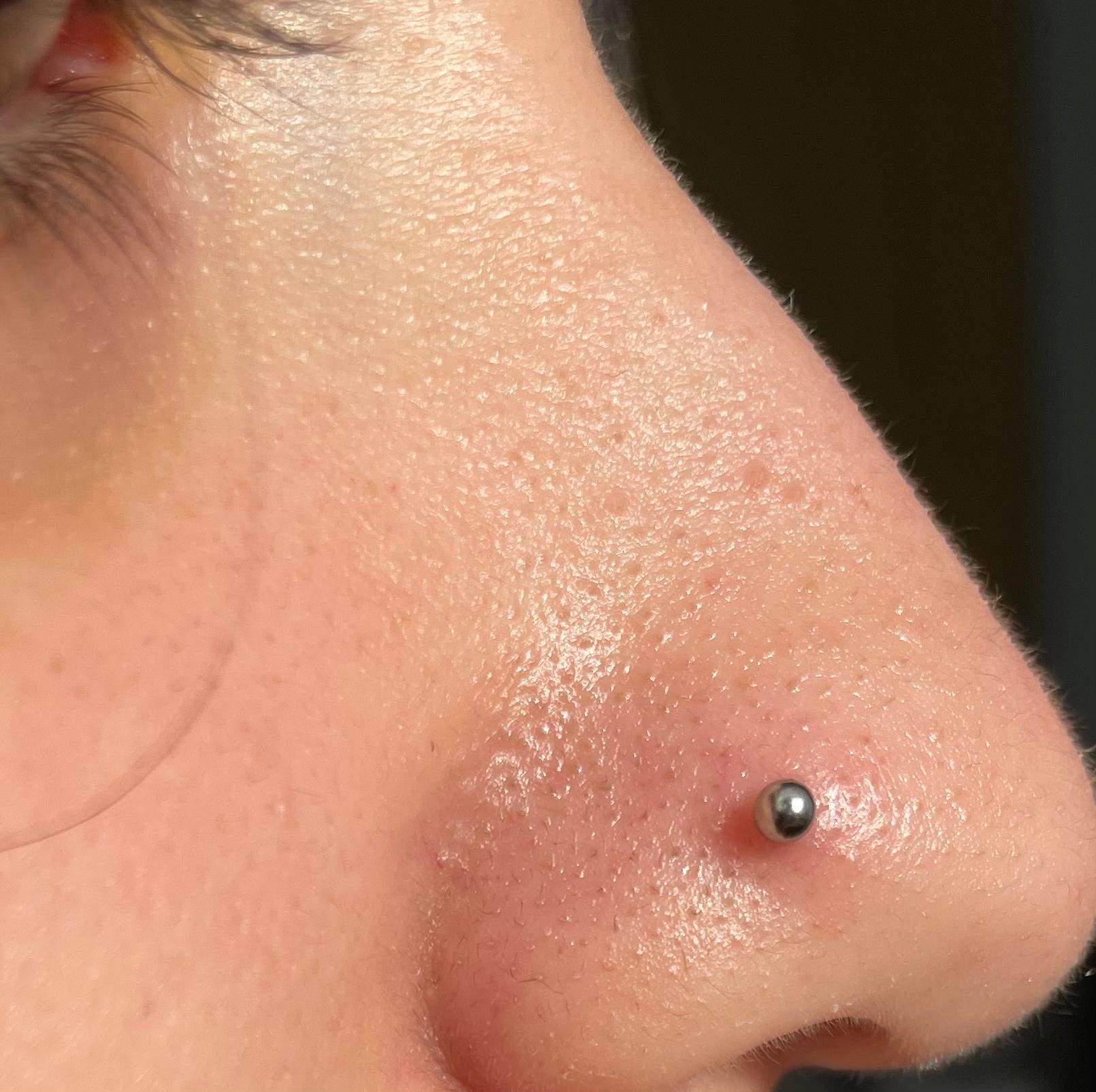Nasenpiercing heilt nicht ab, ist immer um den stichkanal rot ...