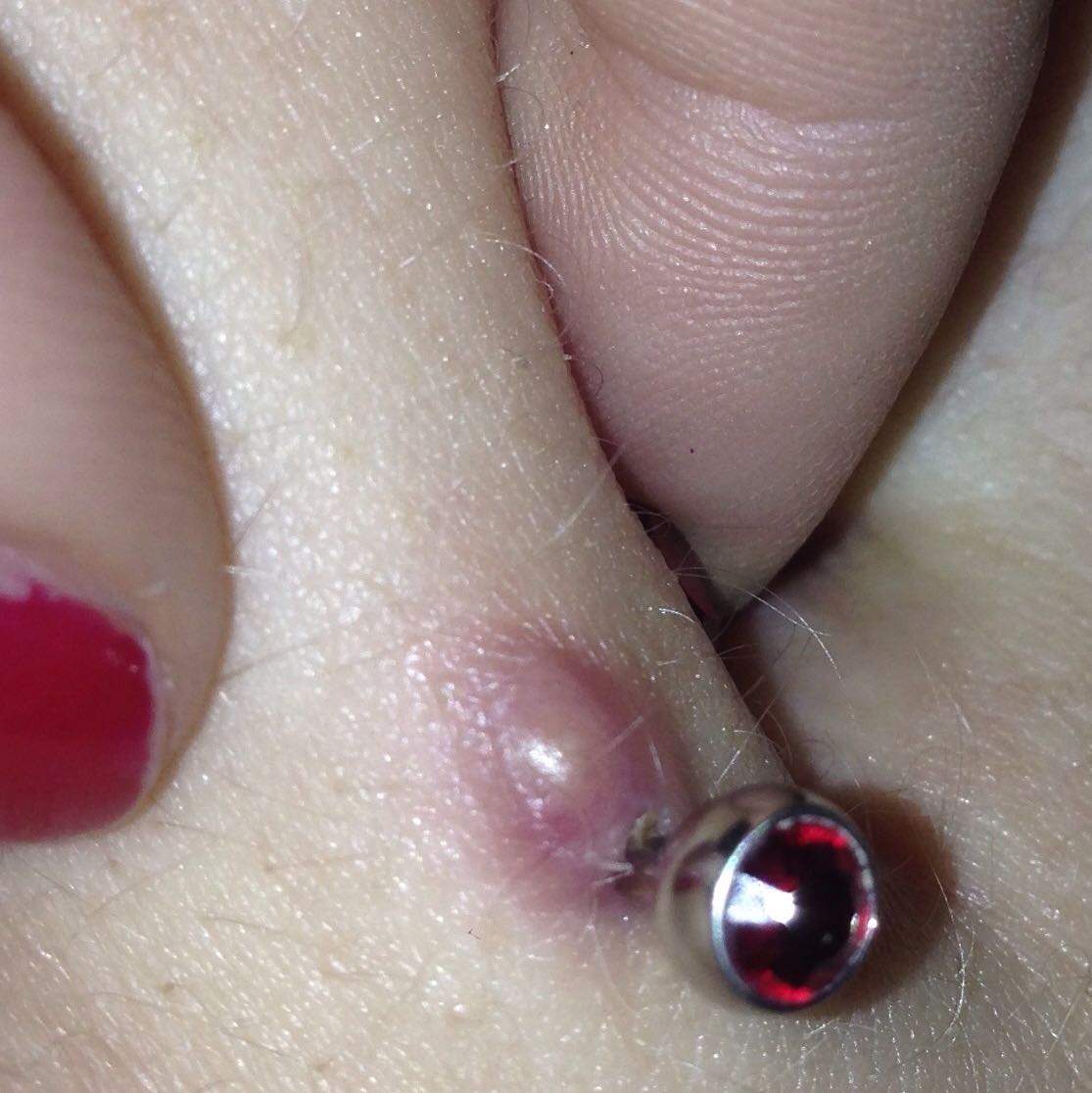 Wann Darf Man Sein Bauchnabelpiercing Wechseln