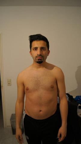 Nerv Eingeklemmt Rucken Schieflage Schmerzen Gesundheit Nerven Orthopade