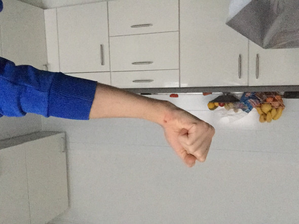 Unten ist ok aber oben geht nix - (Nerven, Lähmug)