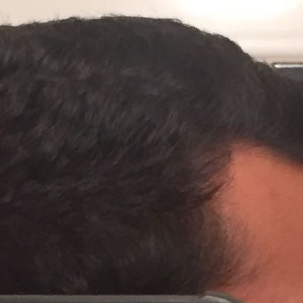 Rechte Seite.
Gleich lang wie oben, - (Haare, undercut, Neue Frisur)
