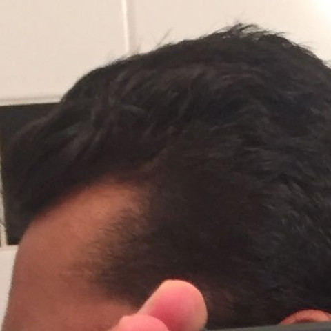 Linke Seite.
Gleich lang wie oben, - (Haare, undercut, Neue Frisur)