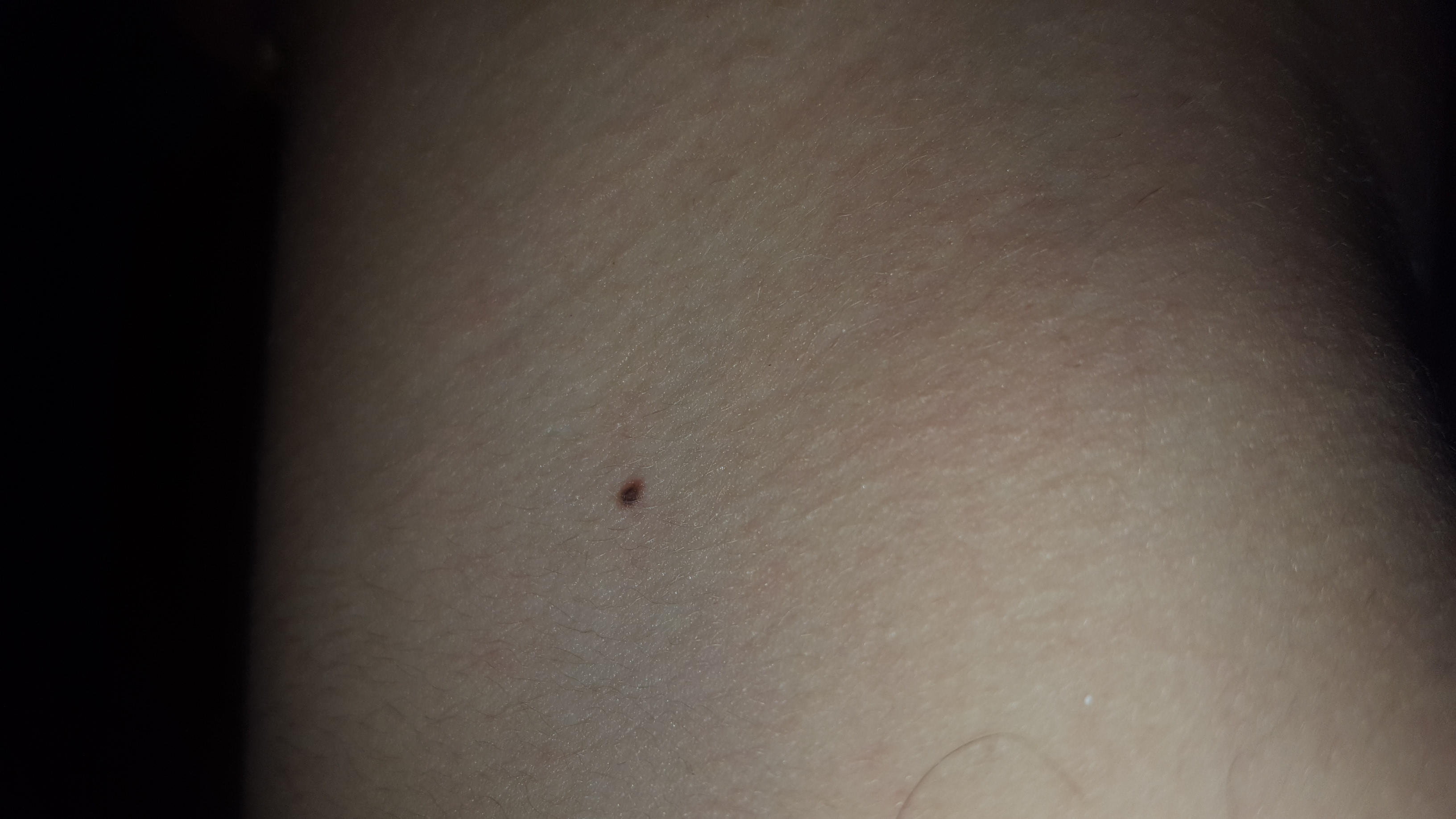 Operative Dermatologie