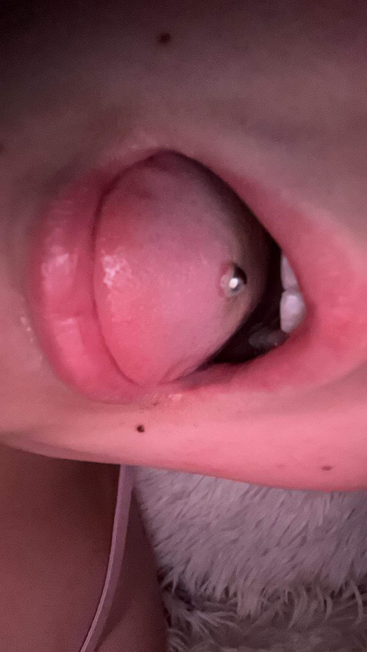 Neues Zungen Piercing kugel versinkt? (Zunge, Piercingschmuck ...
