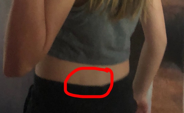 Nierenschmerzen Hab Angst Schmerzen Nieren Nierenschmerzen Hab Angst Schmerzen Nieren