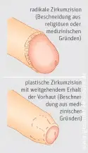 Normal? (Jungs, Sexualitt, Selbstbefriedigung) Normal? (Jungs, Sexualitt, Selbstbefriedigung)