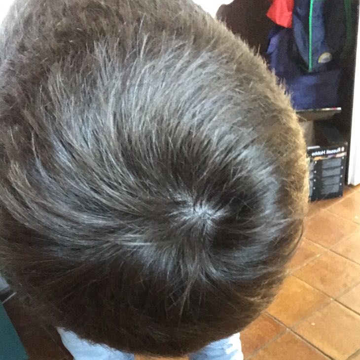 Normaler Wirbel? (Haare)