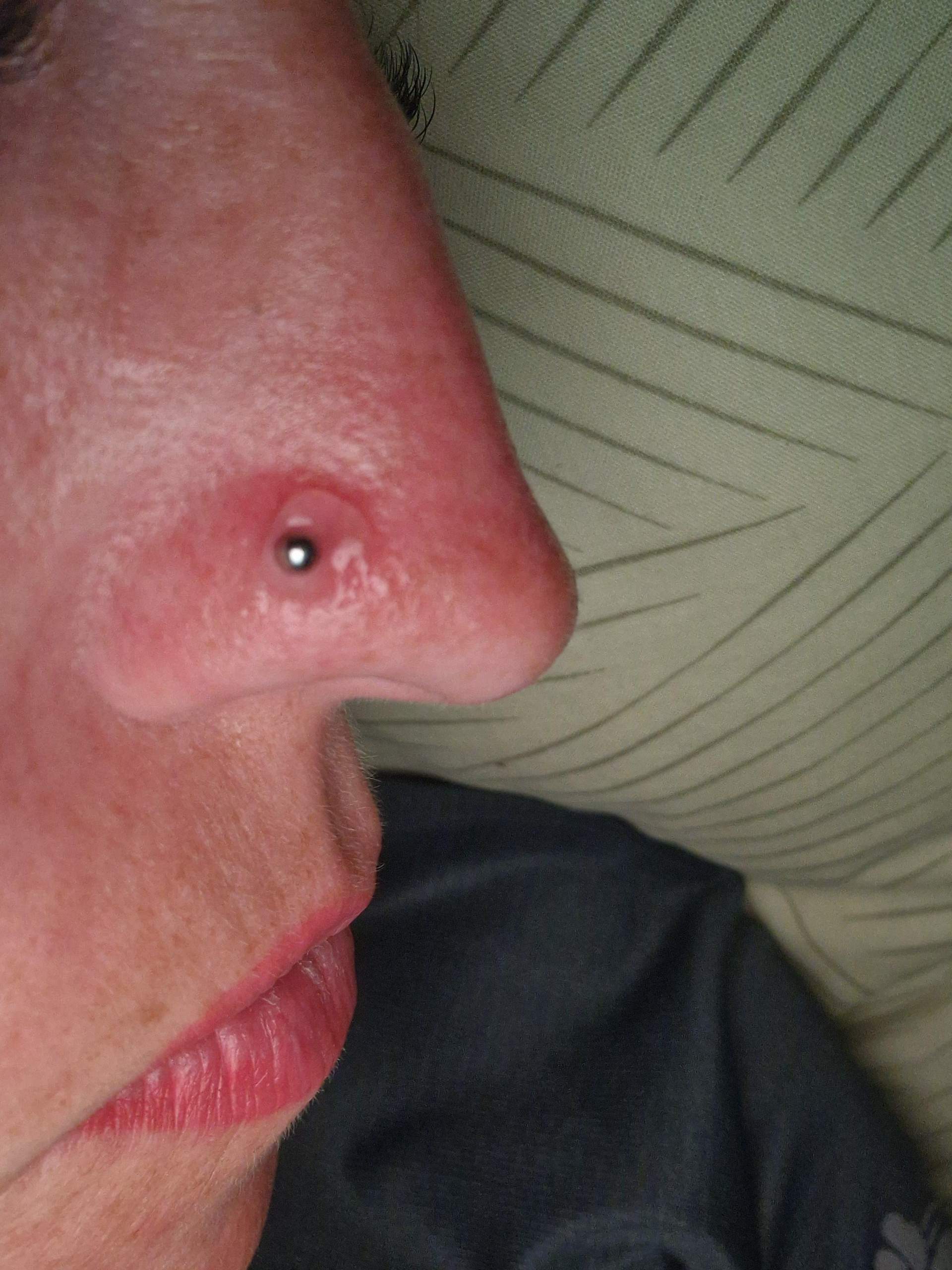 Nostril immer rot? (Piercing, Entzündung)