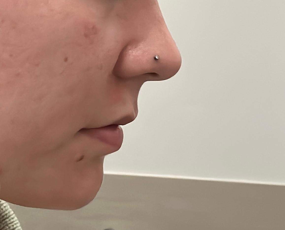 Woher Weiß Ich Ob Mir Ein Nasenpiercing Steht www.gutefrage.net