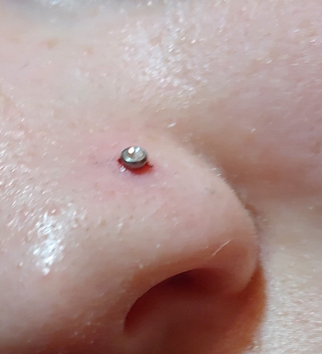 Wie Schnell Wächst Ein Nasenpiercing Zu