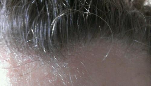 Stirn - (Mädchen, Haare, Haut)