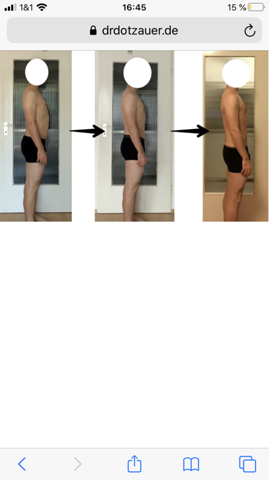 Oberkorper Wirkt Dicker Durch Hohlkreuz Gesundheit Und Medizin Sport Und Fitness Korper Oberkorper Wirkt Dicker Durch Hohlkreuz Gesundheit Und Medizin Sport Und Fitness Korper