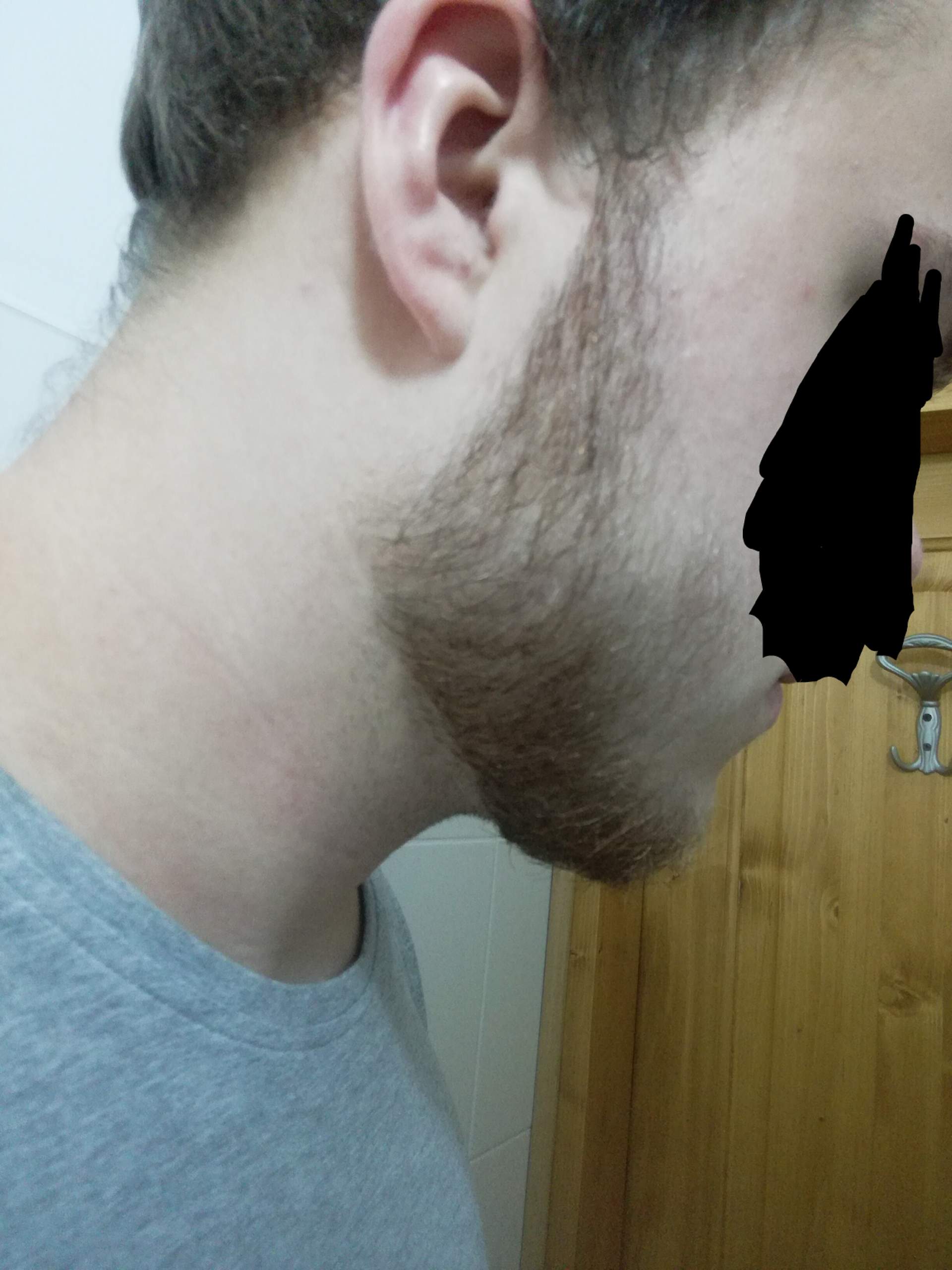 Nicht unterlippenbart wächst Bart wachsen
