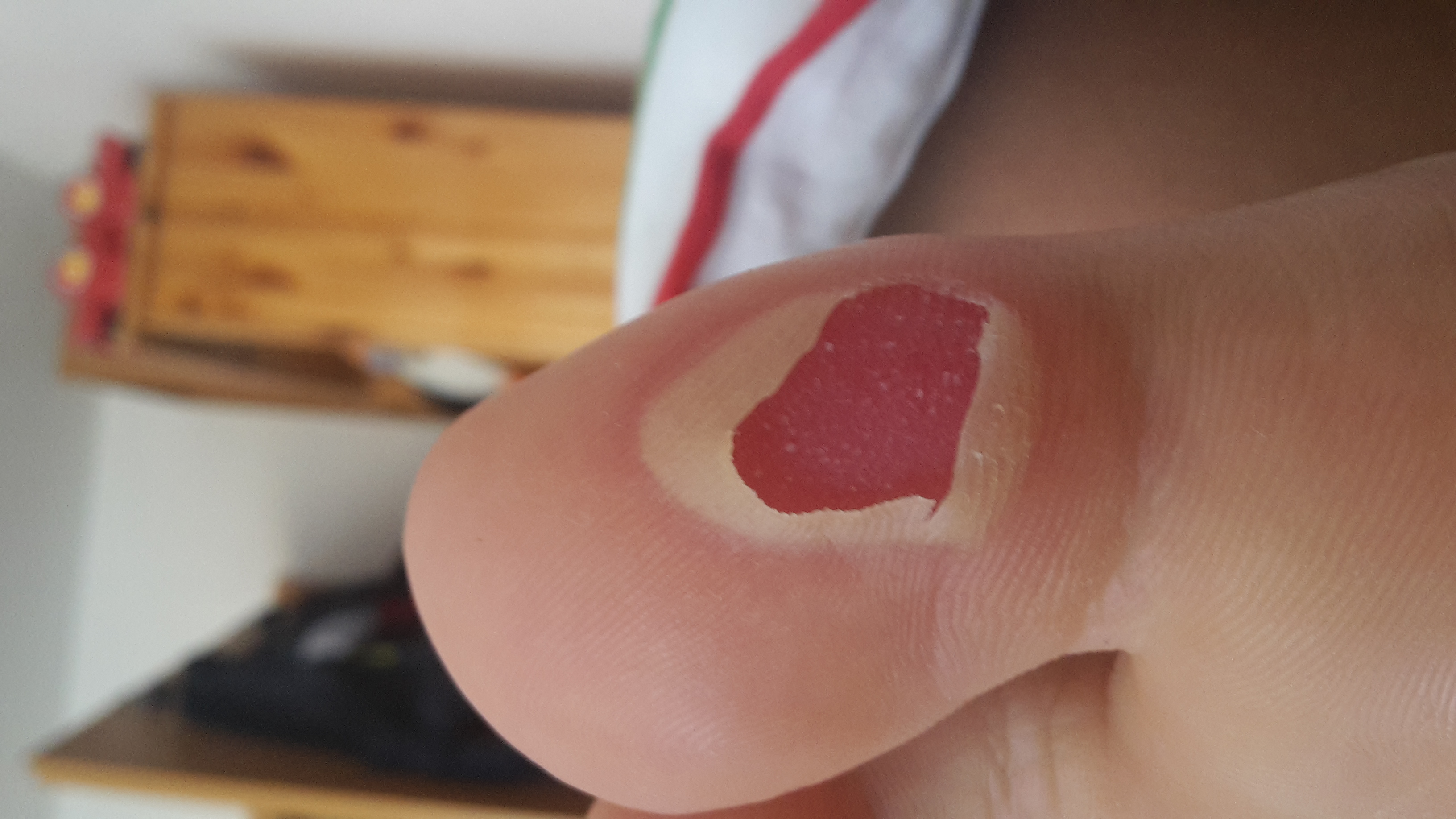 Offene Blase am Zeh? (Gesundheit und Medizin, Körper, Füße) Offene Blase am Zeh? (Gesundheit und Medizin, Körper, Füße)