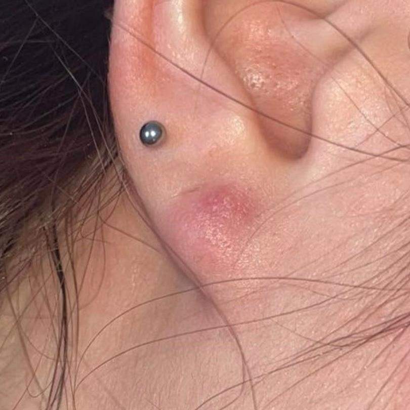 Ohrläppchen entzündet? (Frauen, Schmerzen, Piercing)