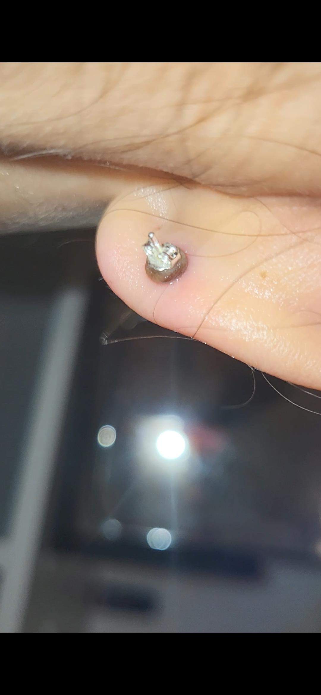 Ohrloch entzündet? (Schmerzen, Piercing, Entzündung)