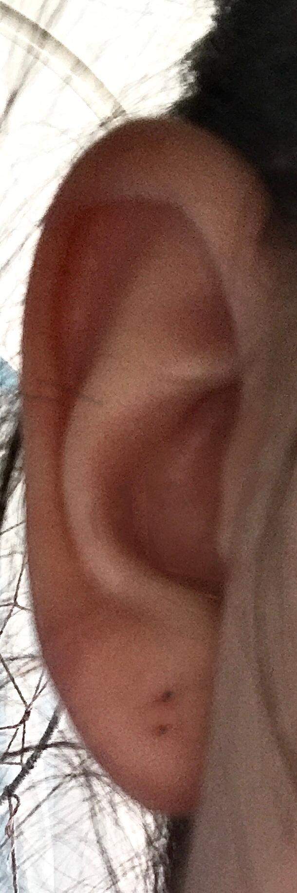 Ohrloch Nach Jahren Wieder Benutzen Schmerzen Beauty Aussehen Ohrloch Nach Jahren Wieder Benutzen Schmerzen Beauty Aussehen