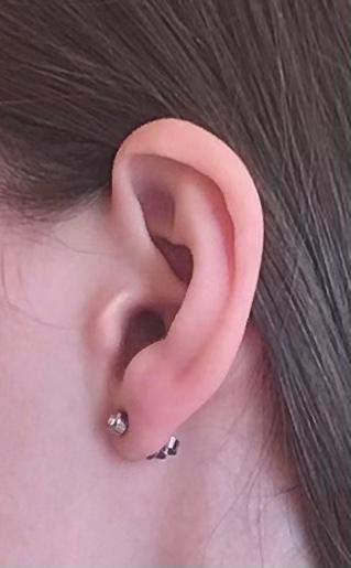 Ohrloch schräg gestochen? (Aussehen, Piercing, Ohr)