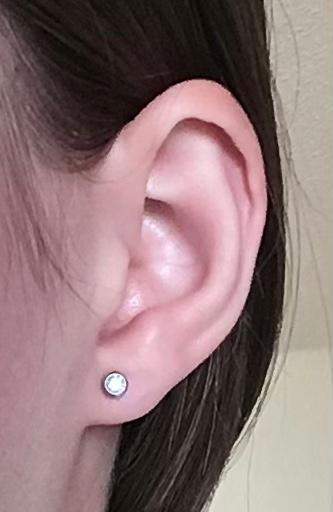 Wie Schnell Wächst Ein Ohrloch Zu Ohrloch zu weit innen/ nah am Gesicht gestochen? (Aussehen, Ohr, Schmuck)