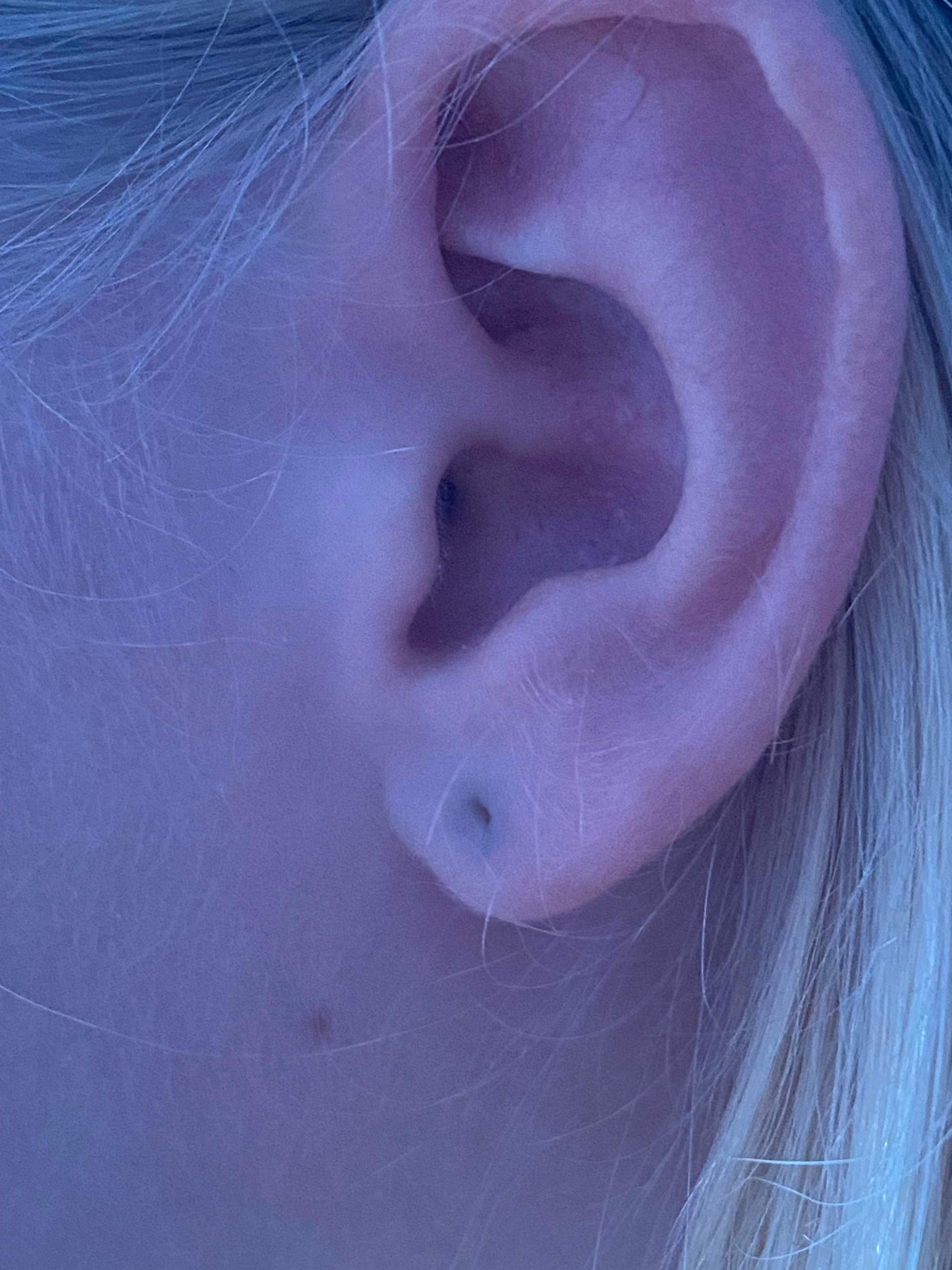 Wie Schnell Wächst Ein Ohrloch Zu Ohrlöcher blau/lila? (Piercing, Ohrloch)
