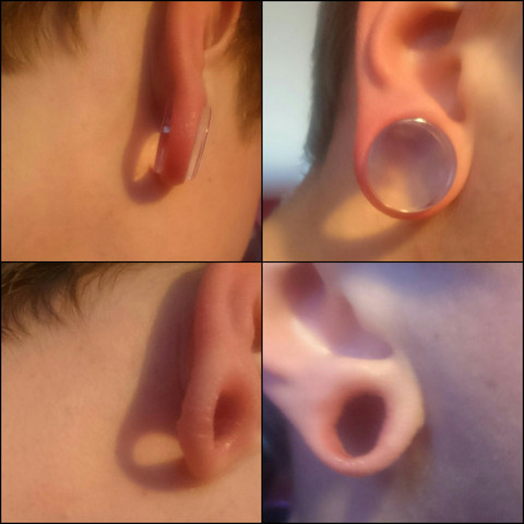 Ohrlocher Dehnen Ohrlappchen Zu Dunn Tunnel Ohrloch Plug