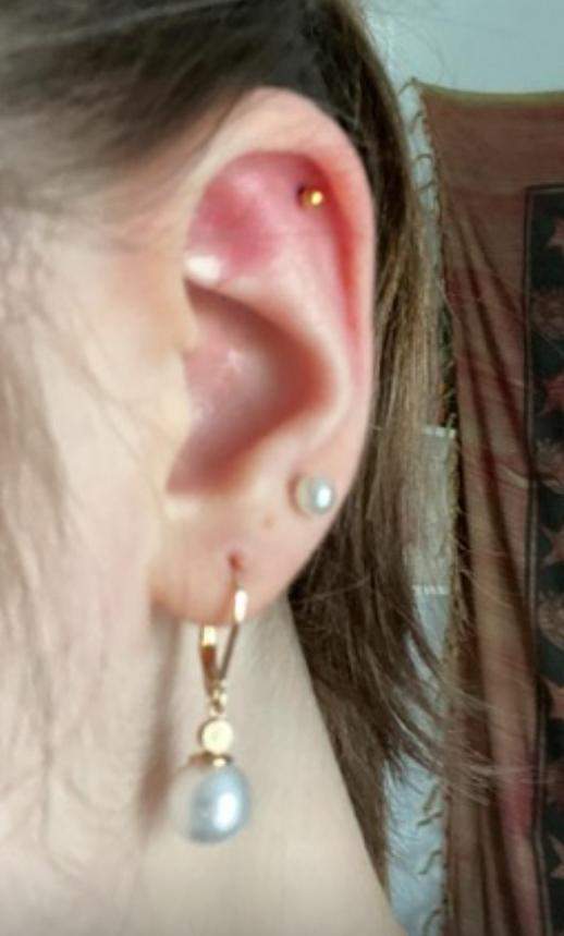 Ohrlöcher zu weit auseinander? (Piercing, Ohrringe, Ohrloch)