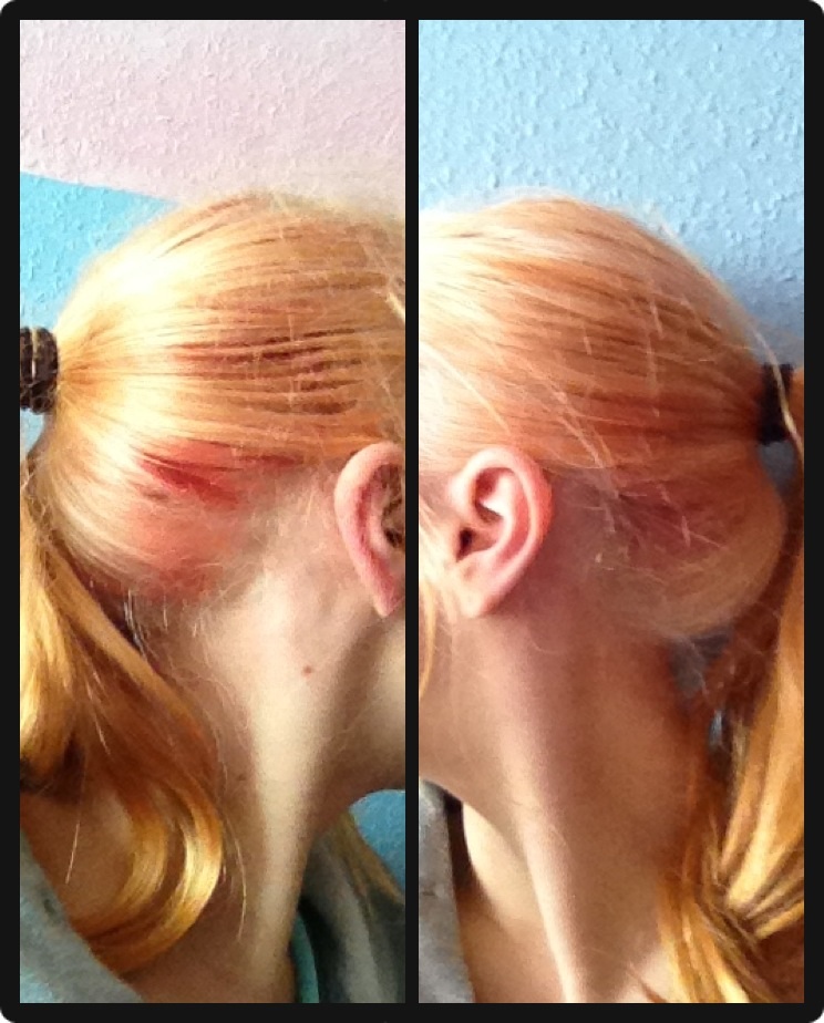 Orangerote stellen nach Blondieren... / (Haare, Beauty, Frisur)