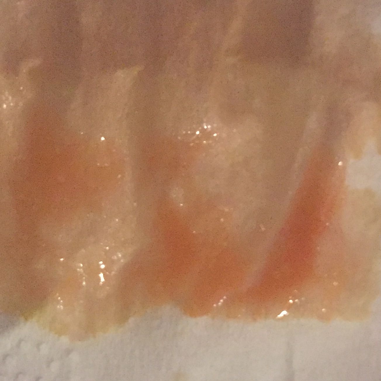 Orangefarbiger Schleim beim Naseputzen! (Gesundheit, Medizin, Nase) Orangefarbiger Schleim beim Naseputzen! (Gesundheit, Medizin, Nase)