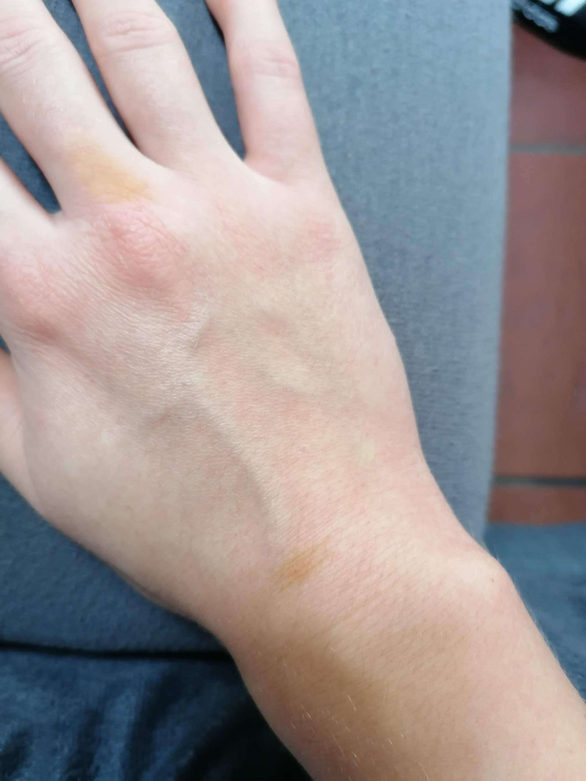 Plötzlich Orangene Flecken Auf Der Haut