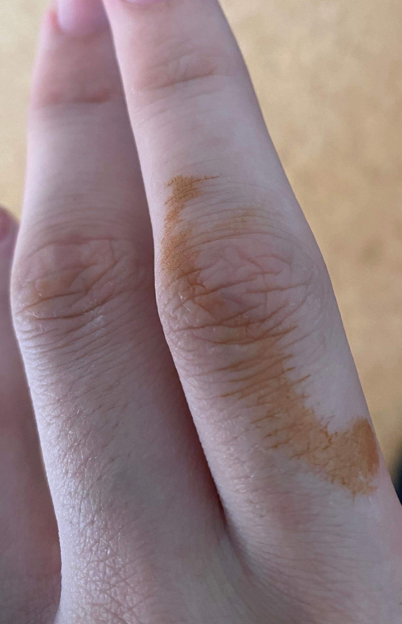 Oranger Fleck Finger nach Aufwachen ? (Haut, Hautpflege, Flecken)