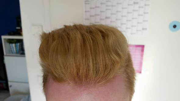 Das sind meine Haare (Nicht in der Sonne/Licht) - (Haare, blond, rot)