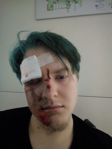 Paracetamol Bei Schurfwunden Im Gesicht Krankenhaus Verletzung Schmerzmittel