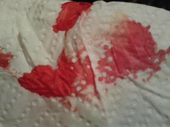 Passt Diese Farbe Meines Blutes Medizin Arzt Blut Passt Diese Farbe Meines Blutes Medizin Arzt Blut
