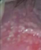 Pickel scheide weiße Weiße Pünktchen