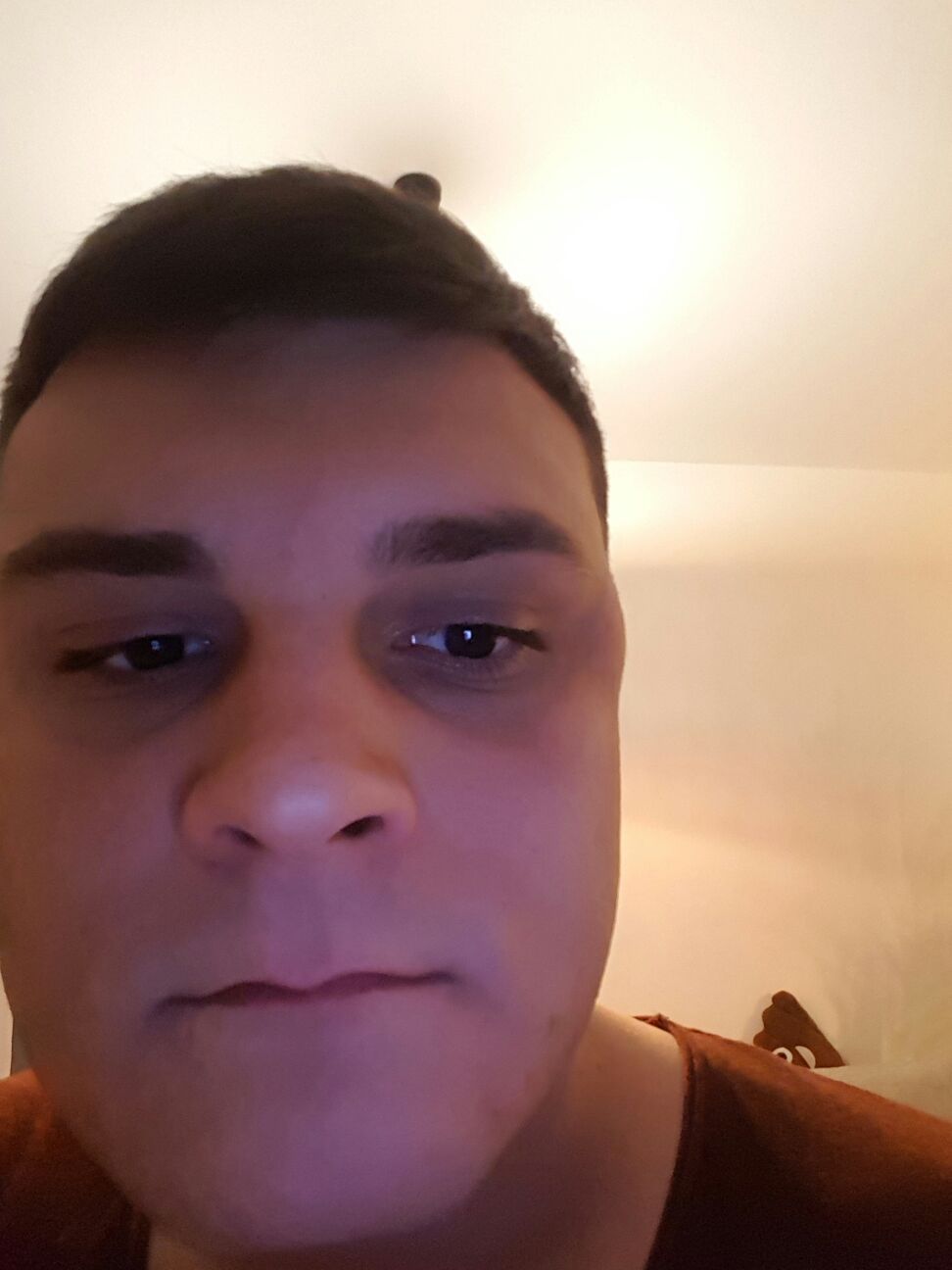 pickel an schläfe pickel an schläfe