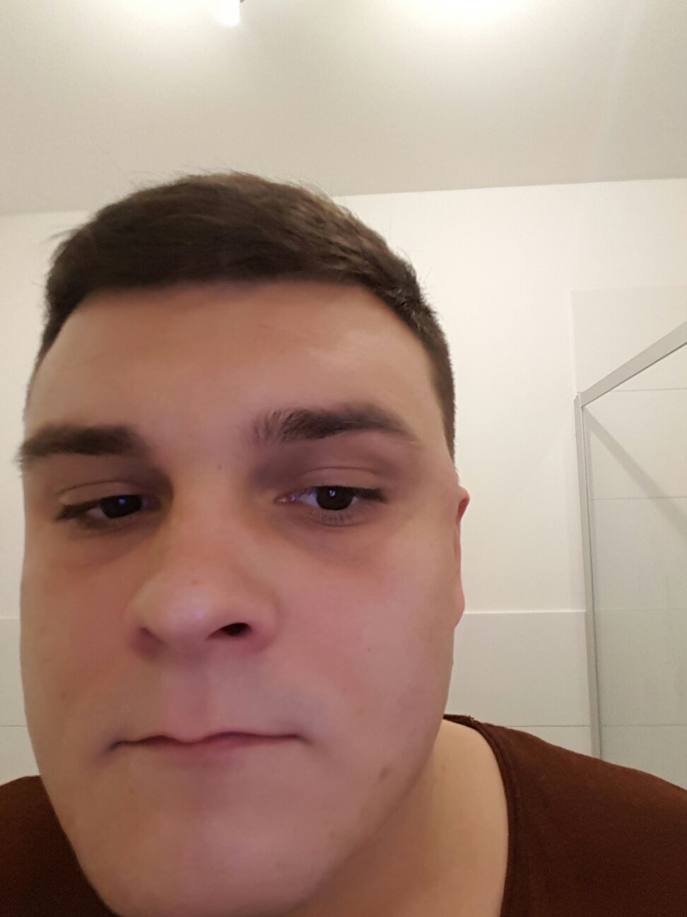 pickel an der schl�fe